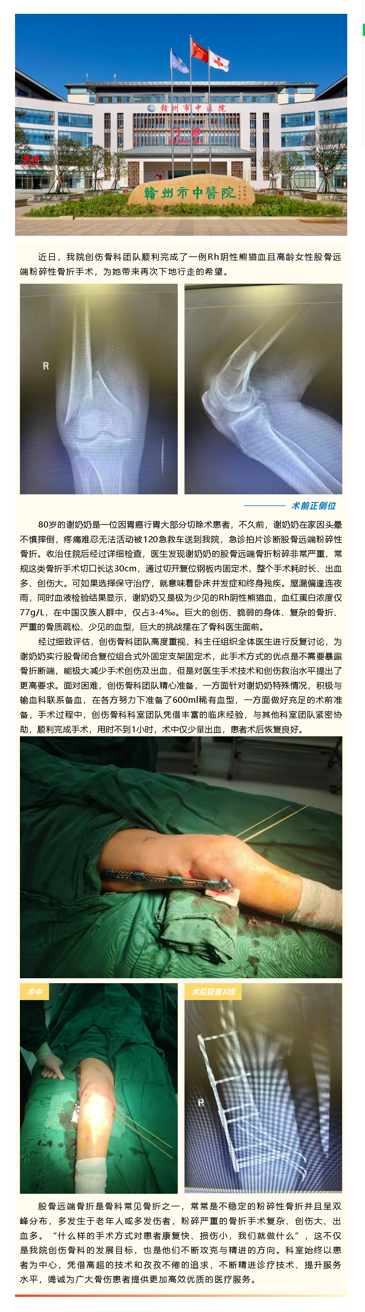 80歲粉碎性骨折阿婆竟是熊貓血，微創(chuàng)閉合復位破解創(chuàng)傷難題.png