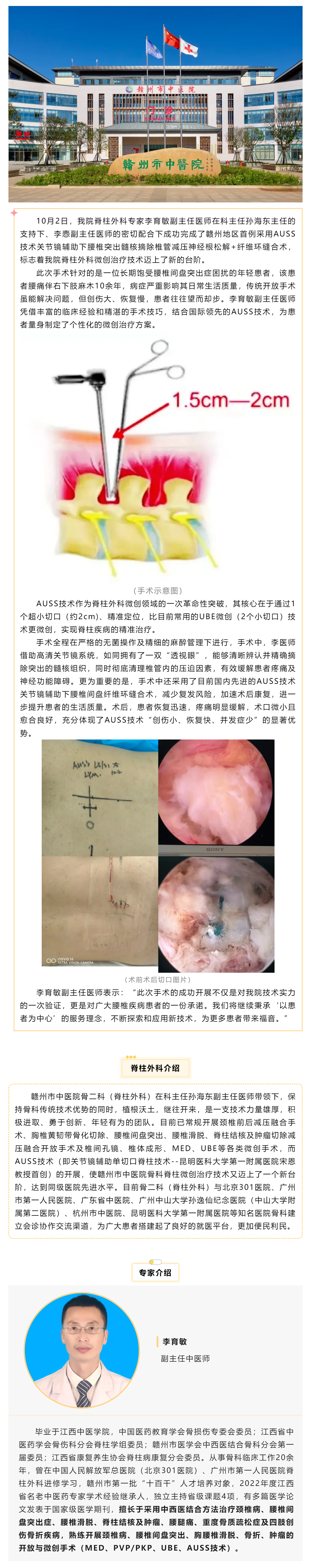 全市首例！我院成功實施AUSS技術(shù)關(guān)節(jié)鏡輔助下腰椎突出髓核摘除椎管減壓神經(jīng)根松解+纖維環(huán)縫合術(shù).png