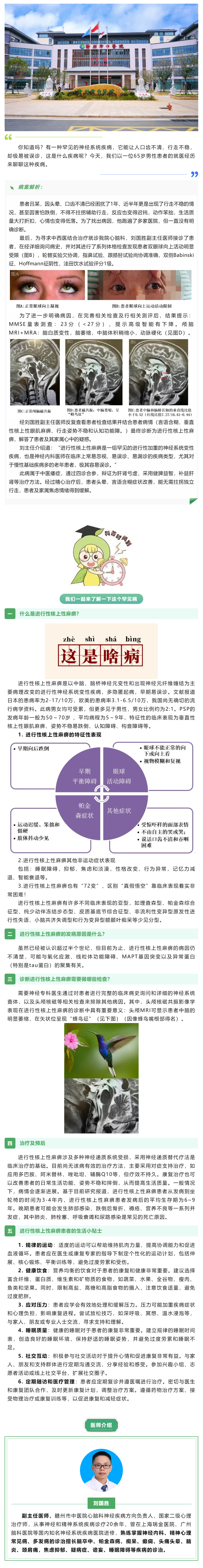 口齒不清、行走不穩(wěn)？警惕這種神經(jīng)系統(tǒng)罕見病&mdash;&mdash;進行性核上性麻痹.png
