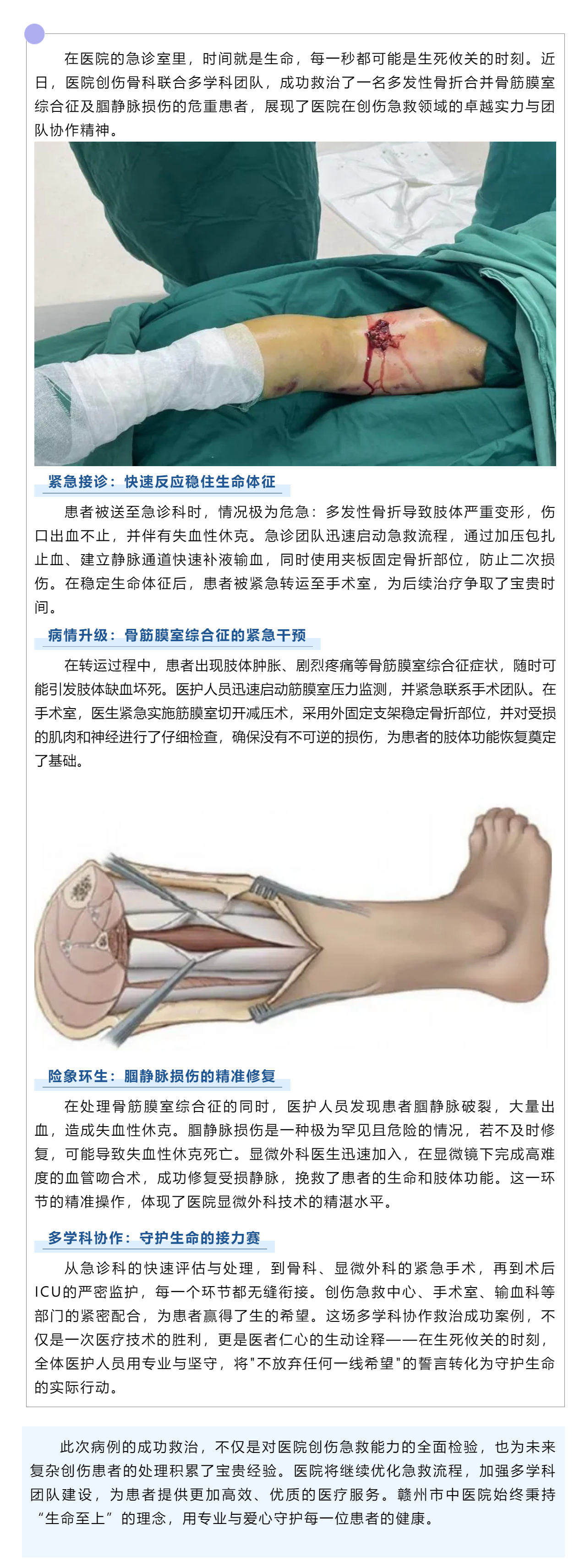 生死時速！多學(xué)科協(xié)作成功救治多發(fā)性骨折合并嚴重并發(fā)癥患者.png