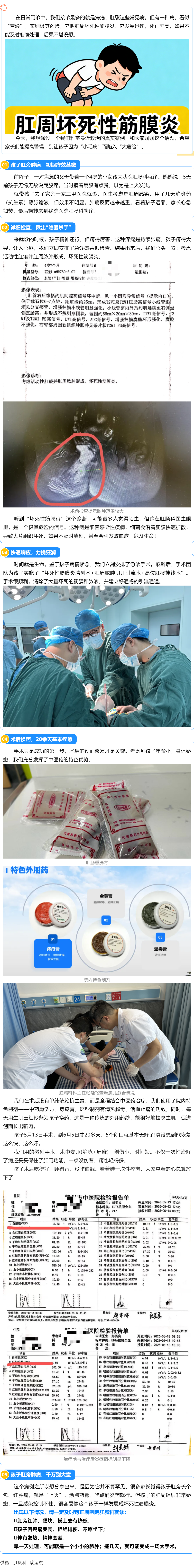 【真實案例】4歲小寶肛周膿腫合并壞死性筋膜炎，中西醫(yī)聯(lián)合治療20余天一次性根治痊愈！.png