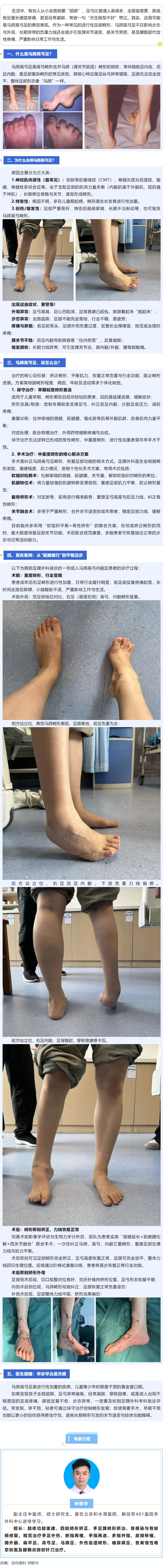 馬蹄高弓足&ne;&ldquo;天生腳型不好&rdquo; _ 矯形手術(shù)幫你放平雙腳，走穩(wěn)人生路.png