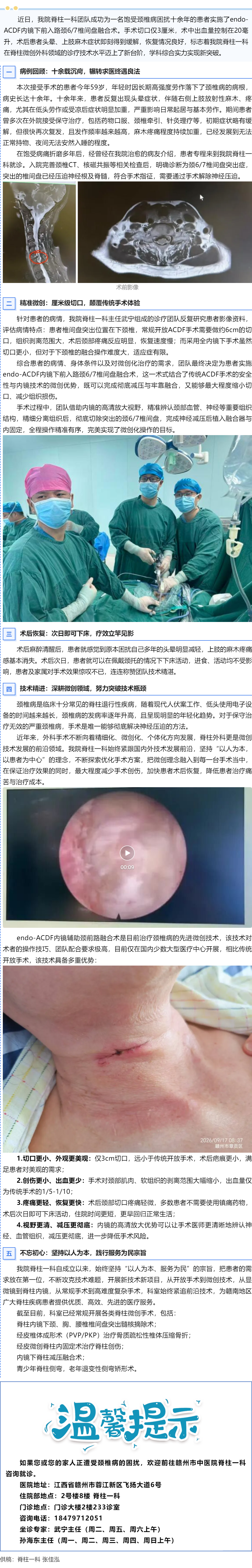 3cm小切口解決頸椎大問(wèn)題&mdash;&mdash;我院脊柱一科微創(chuàng)技術(shù)再獲突破.png